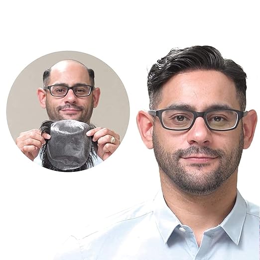 Hair Patch for Men and Women in Gurgaon